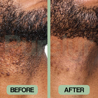 PureSmooth™ Roll On Recovery