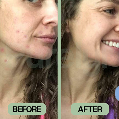 Reveal Your Radiance, Embrace Flawless Skin!